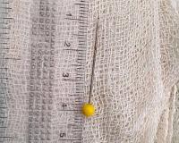 किशोरी की सांस की नली में पिन फंसी