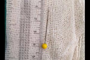 किशोरी की सांस की नली में पिन फंसी