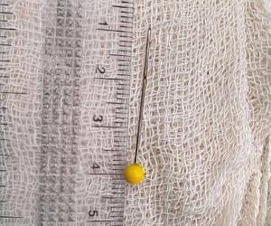 किशोरी की सांस की नली में पिन फंसी